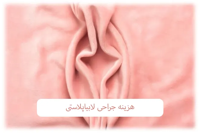 هزینه لابیاپلاستی
