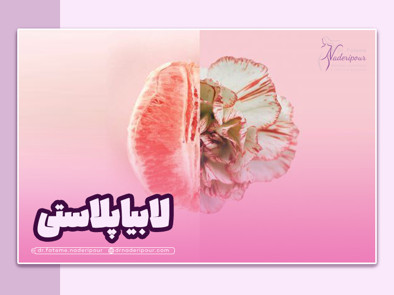 لابیاپلاستی چیست و چگونه انجام می شود؟