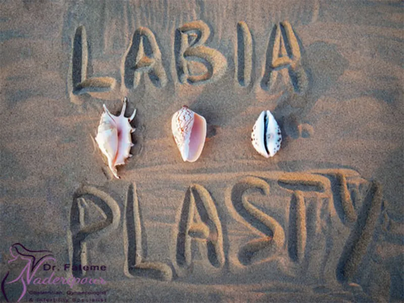 بهترین سن لابیاپلاستی