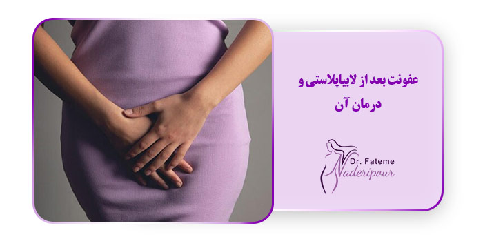 عفونت بعد از لابیاپلاستی و درمان آن