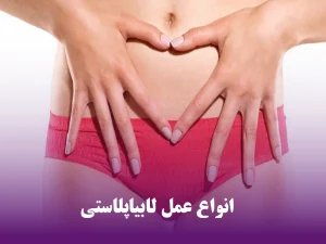 انواع عمل لابیاپلاستی