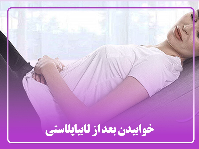 خوابیدن بعد از لابیاپلاستی