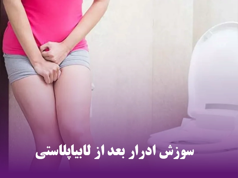 سوزش ادرار بعد از لابیاپلاستی