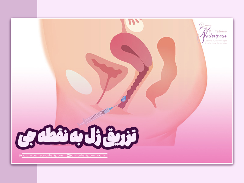 تزریق ژل به نقطه جی چگونه انجام می شود؟