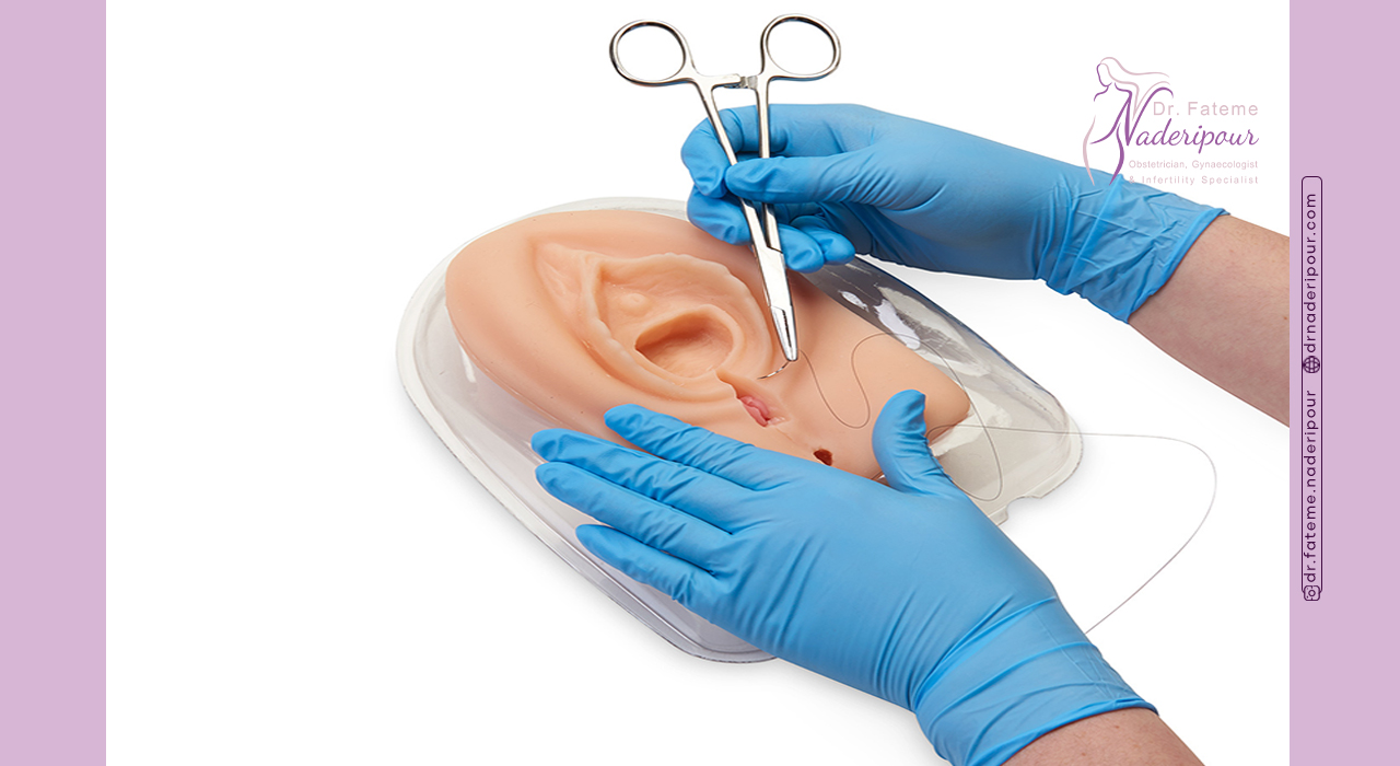 پرینورافی برای چه کسانی مناسب است؟