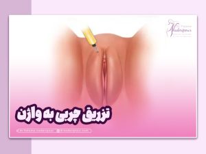 تزریق چربی به واژن