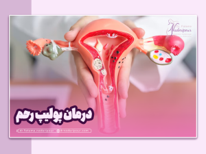 درمان پولیپ رحم