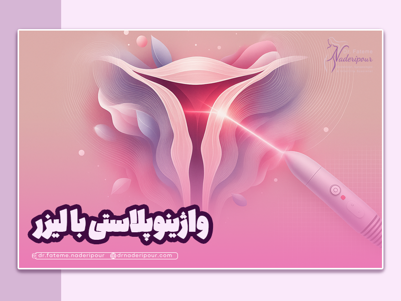 واژینوپلاستی با لیزر